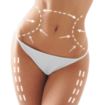 coolsculpting model in white