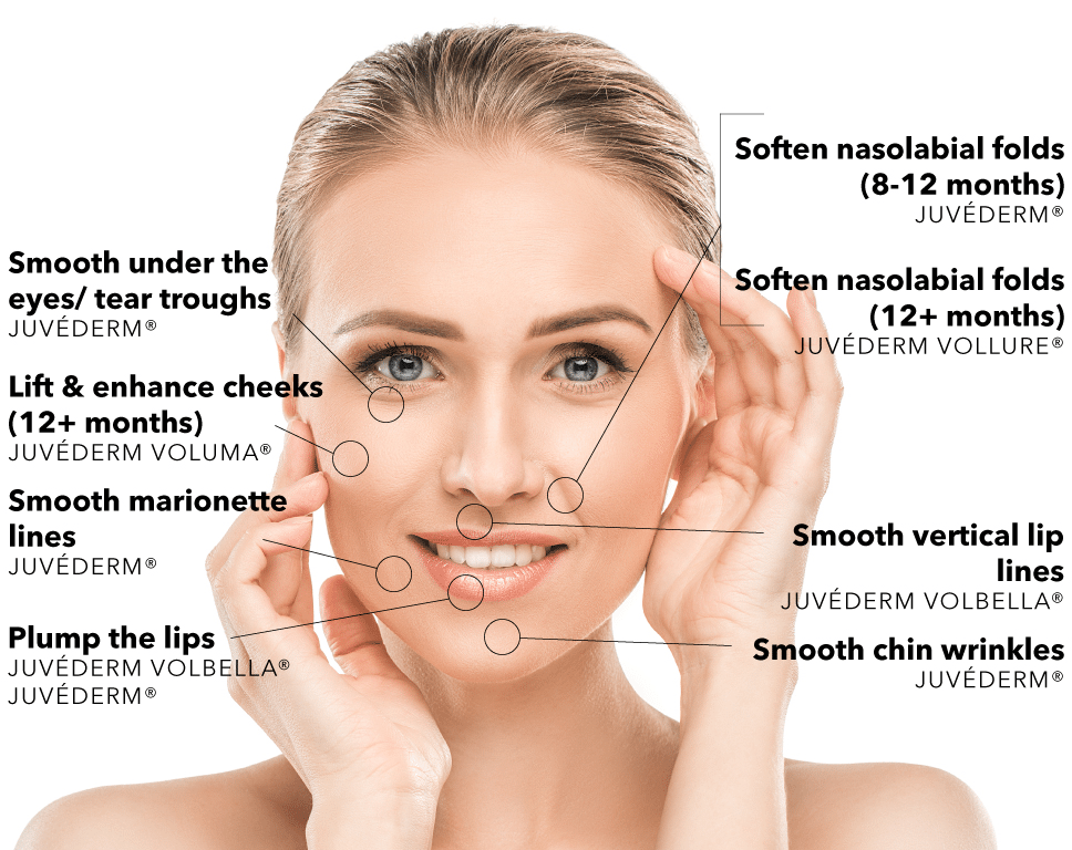 Newtown dermal fillers