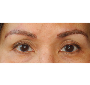 Eyebrows Before & After Image