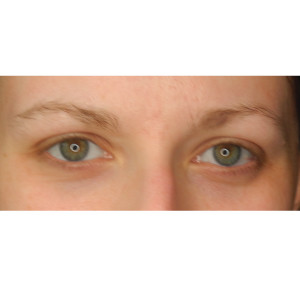 Eyebrows Before & After Image