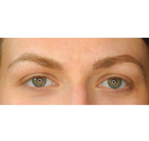 Eyebrows Before & After Image