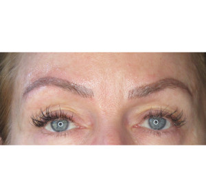 Eyebrows Before & After Image