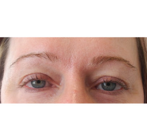 Eyebrows Before & After Image