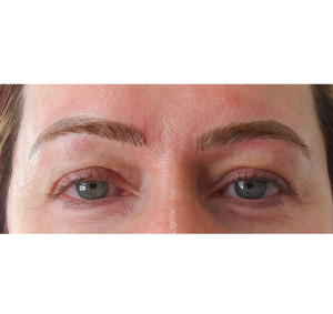 Eyebrows Before & After Image