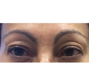 Eyebrows Before & After Image