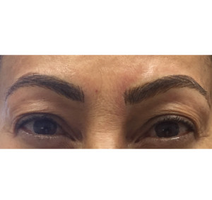 Eyebrows Before & After Image