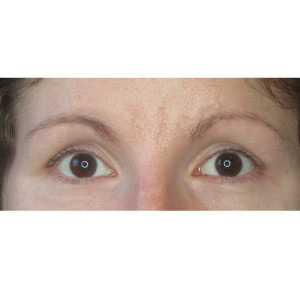 Eyebrows Before & After Image