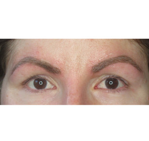 Eyebrows Before & After Image