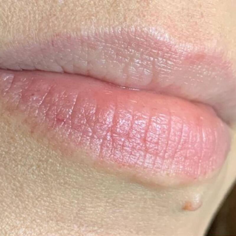 Lip Blushing Before & After Image