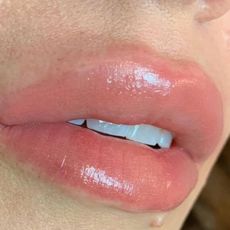 Lip Blushing Before & After Image