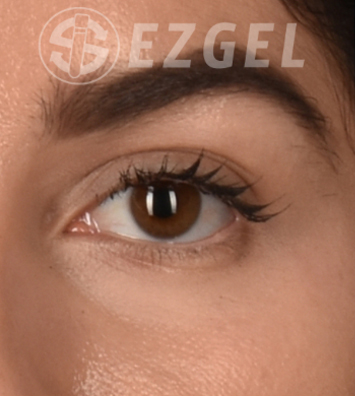 PRF ezGEL Before & After Image