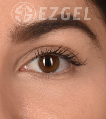 PRF ezGEL Before & After Image